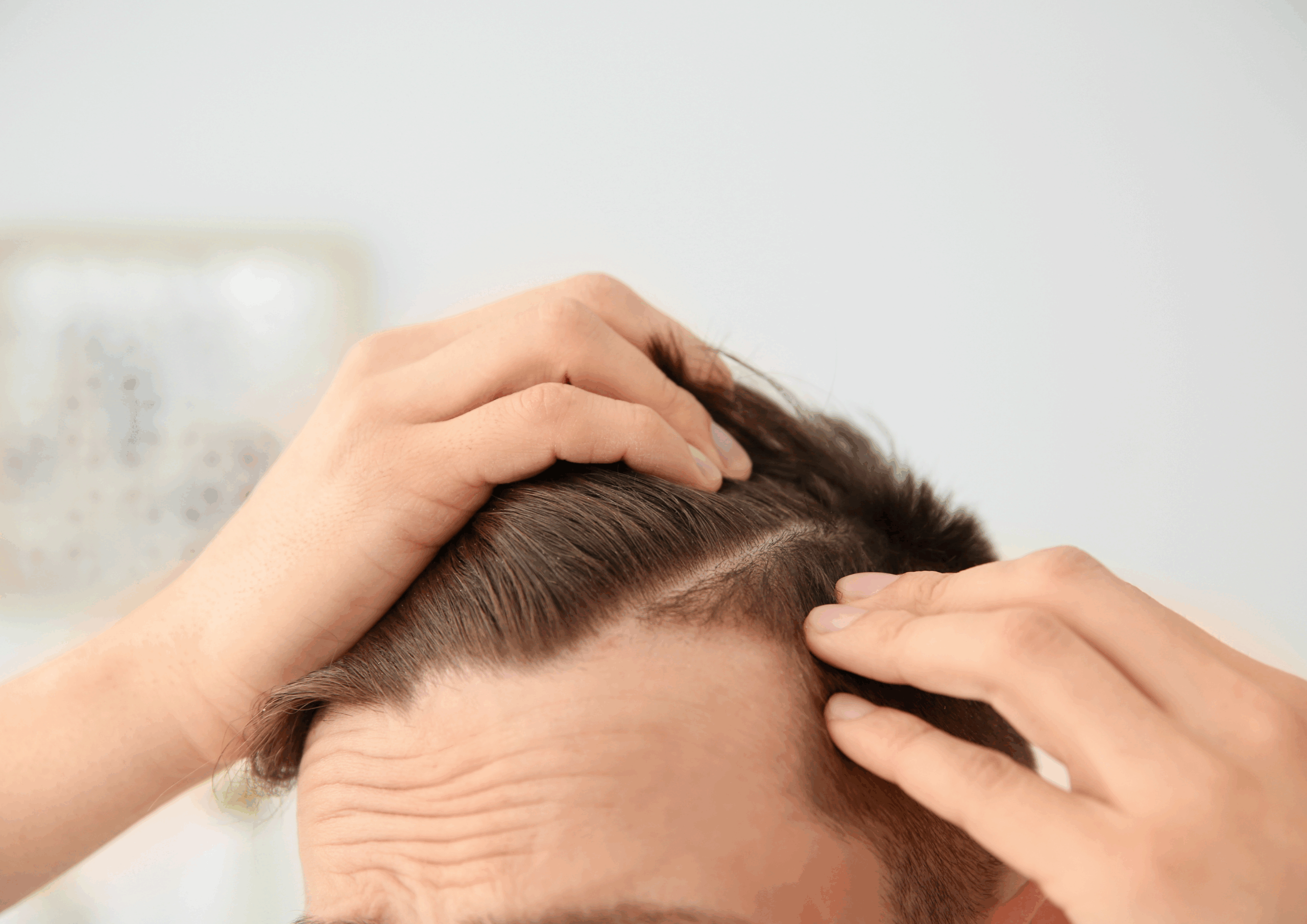 AGAとホルモンの関係のイメージ