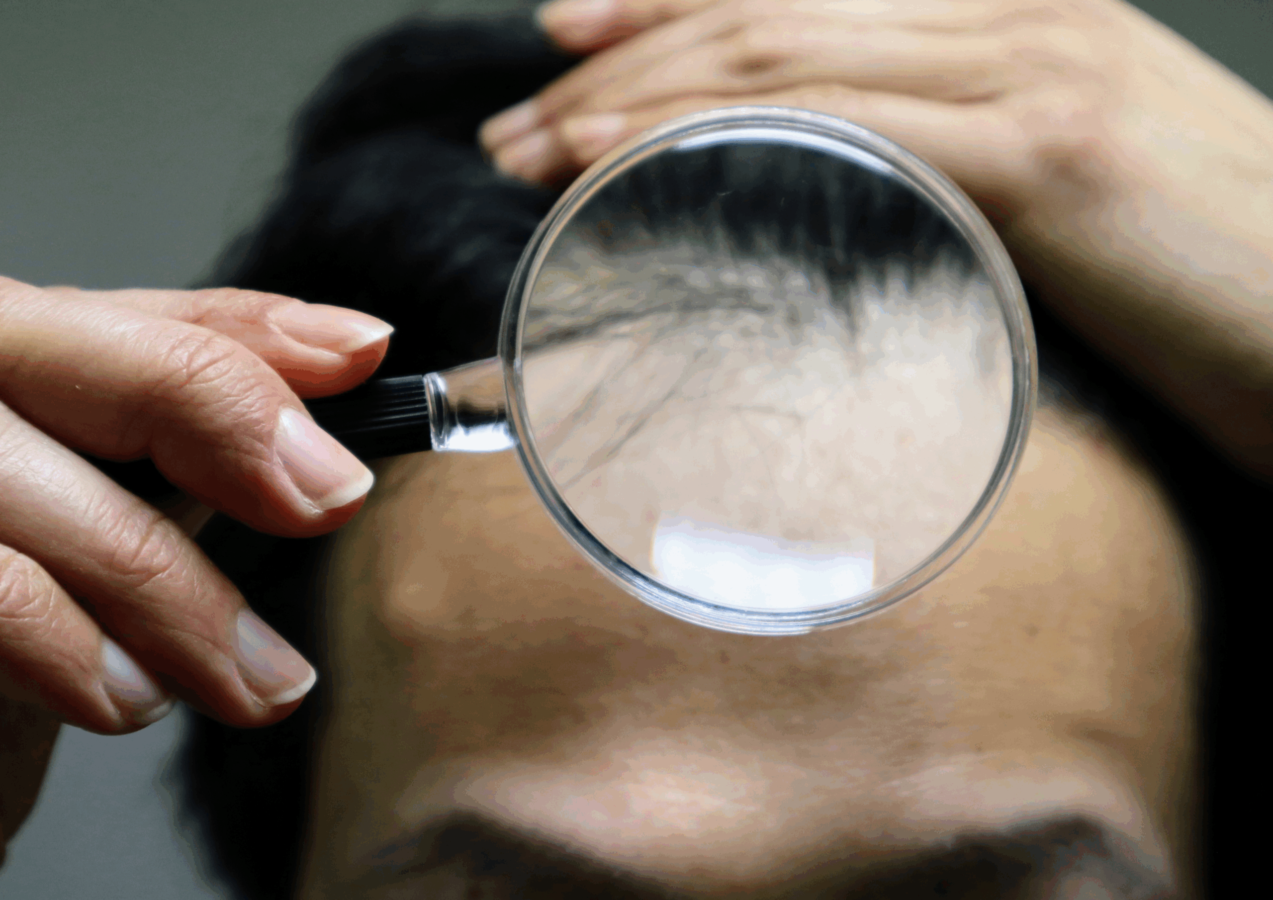 AGAの症状のイメージ