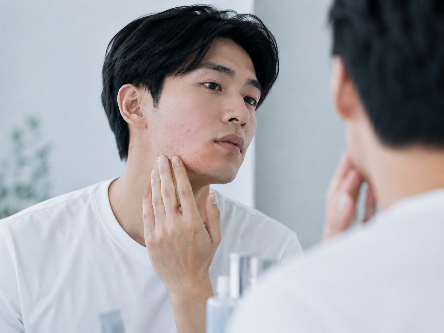 摩擦や生活習慣によるニキビ