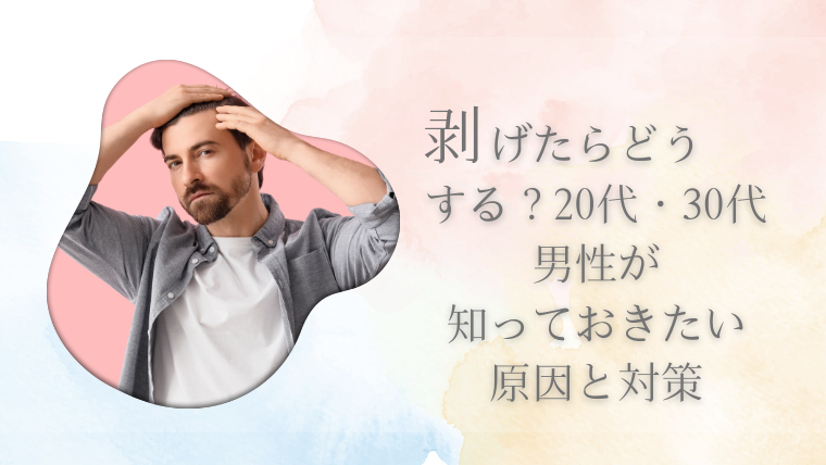 剥げたらどうする？20代・30代男性が知っておきたい原因と対策