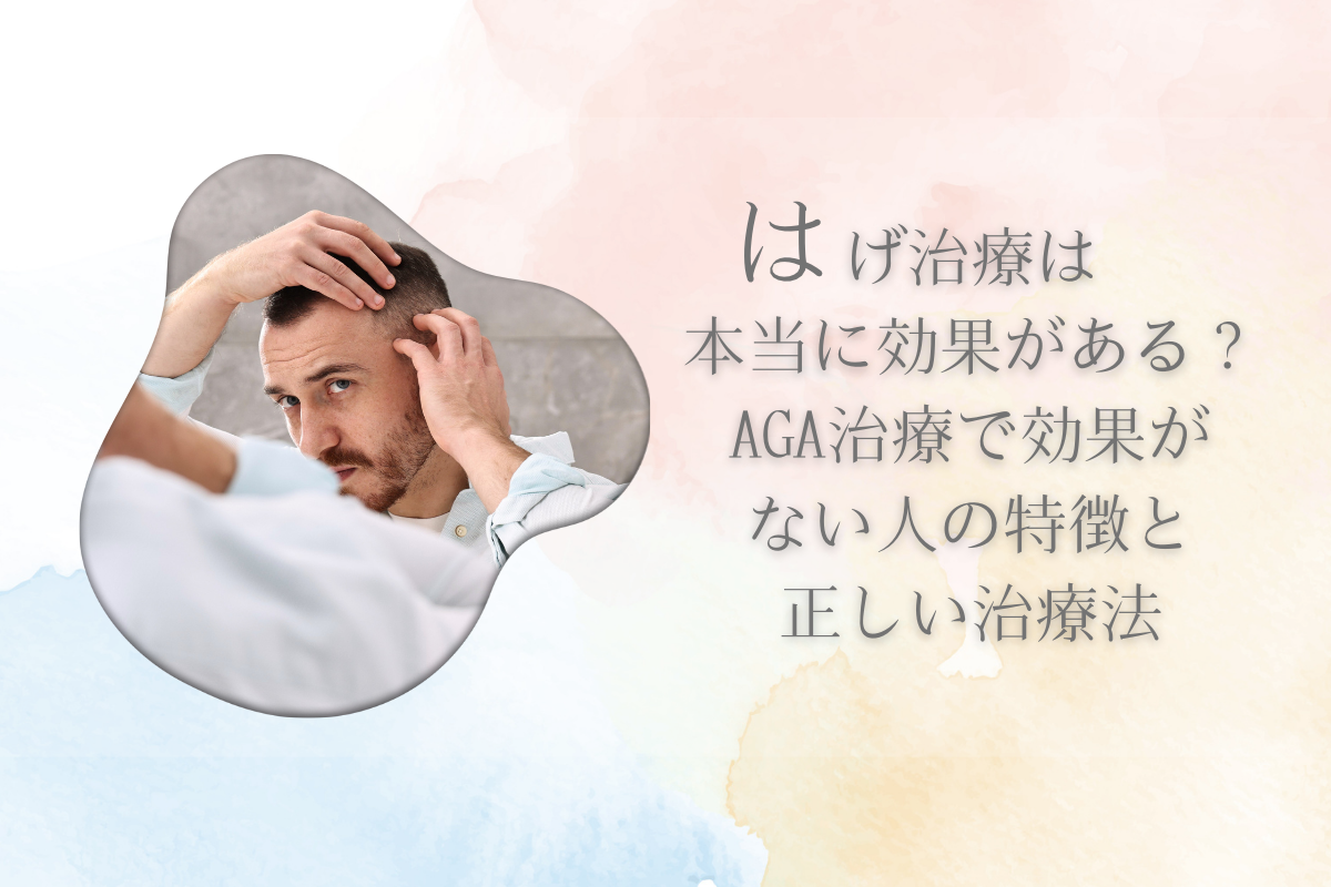 はげ治療は本当に効果がある？AGA治療で効果がない人の特徴と正しい治療法