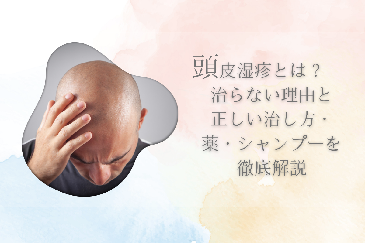 頭皮湿疹とは？治らない理由と正しい治し方・薬・シャンプーを徹底解説