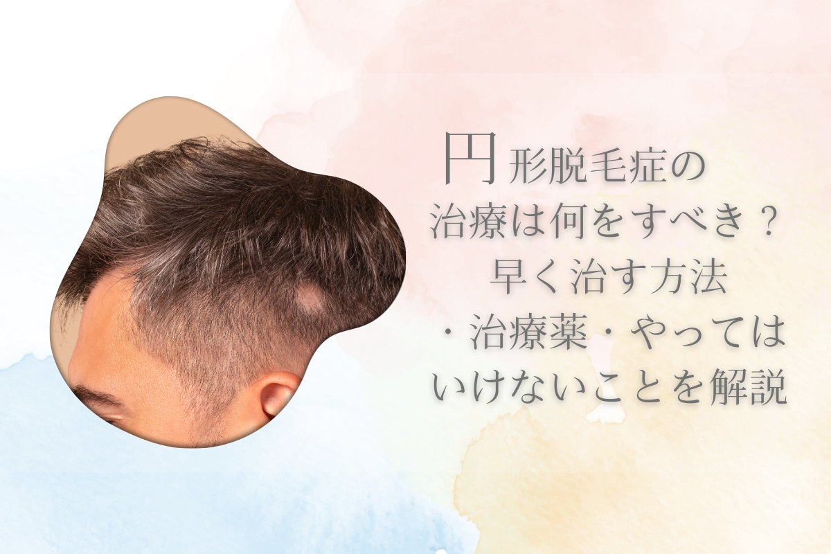 円形脱毛症の治療は何をすべき？早く治す方法・治療薬・やってはいけないことを解説