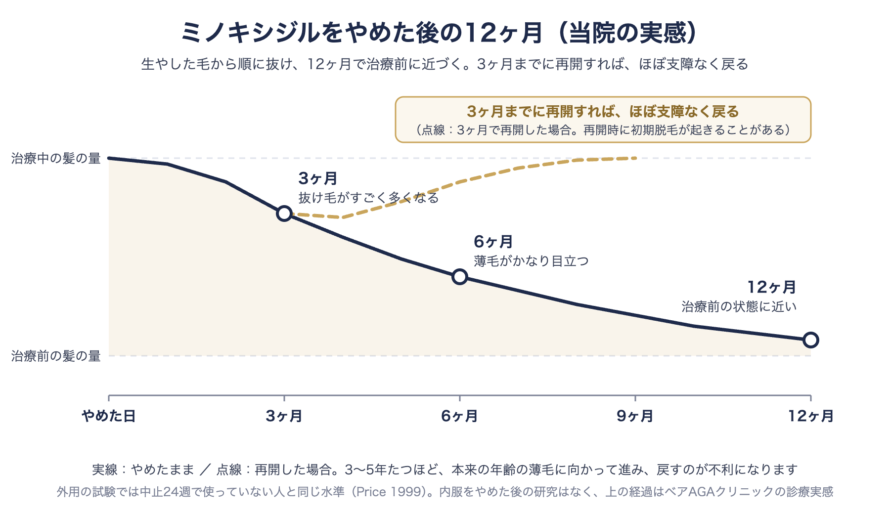 ミノキシジルをやめた後の経過図：3ヶ月で抜け毛が増え、6ヶ月で薄毛が目立ち、12ヶ月で治療前に近づく。3ヶ月までに再開すればほぼ支障なく戻る