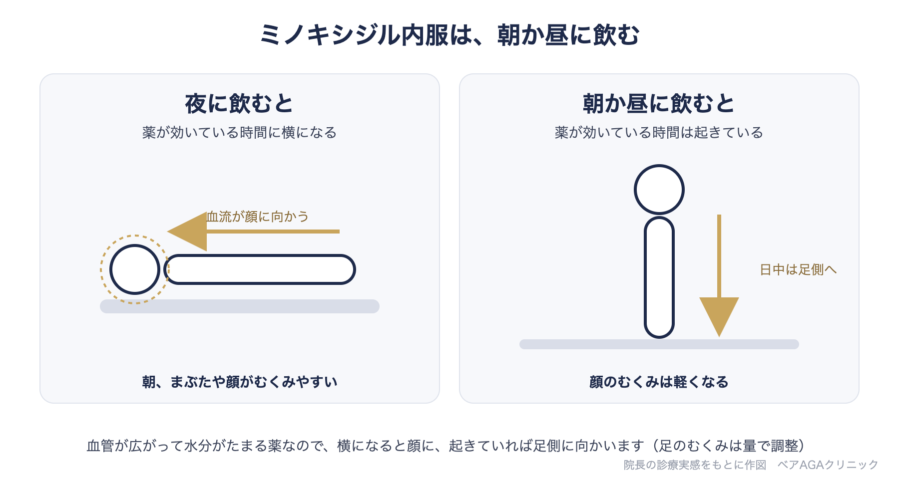 ミノキシジルのむくみ対策の図:夜に飲んで横になると血流が顔に向かい朝まぶたがむくみやすい。朝か昼に飲めば日中は足側へ向かい顔のむくみは軽くなる