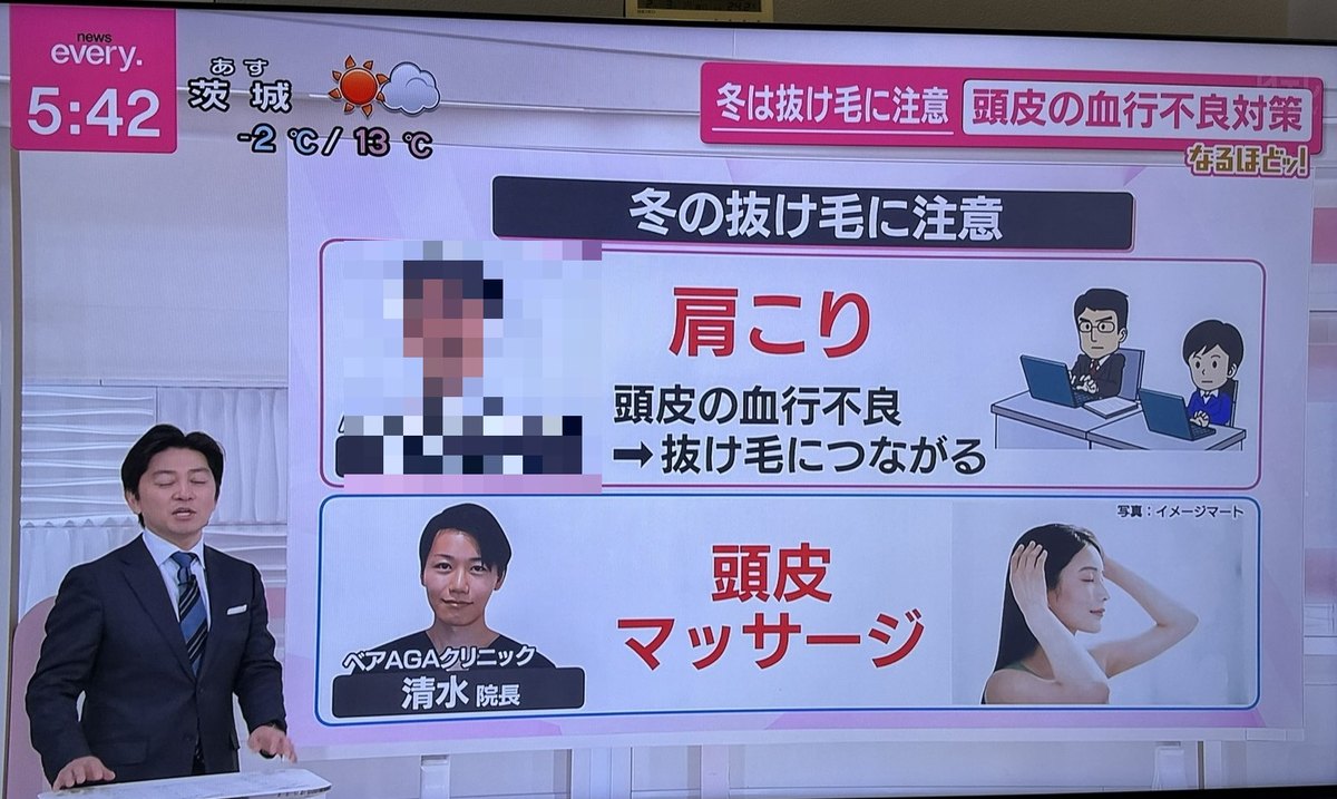 日本テレビ news every. 出演時の放送画面(ベアAGAクリニック 清水崇裕院長)