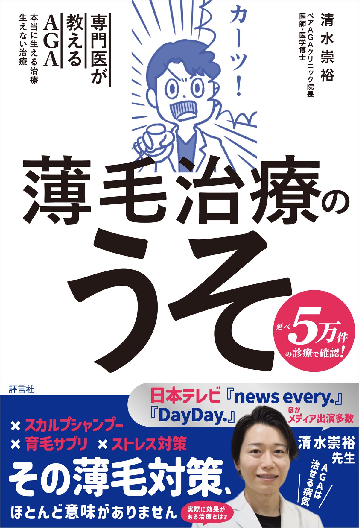 『薄毛治療のうそ』表紙